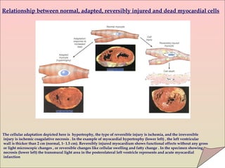 Cell injury, cell death & adaptations by Dr Nadeem (RMC) | PPT
