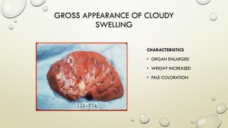 GROSS APPEARANCE OF CLOUDY
SWELLING
CHARACTERISTICS
• ORGAN ENLARGED
• WEIGHT INCREASED
• PALE COLORATION
 
