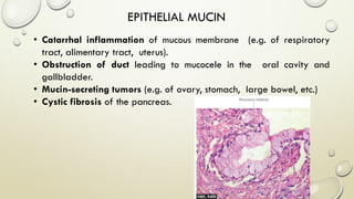 EPITHELIAL MUCIN
• Catarrhal inflammation of mucous membrane (e.g. of respiratory
tract, alimentary tract, uterus).
• Obstruction of duct leading to mucocele in the oral cavity and
gallbladder.
• Mucin-secreting tumors (e.g. of ovary, stomach, large bowel, etc.)
• Cystic fibrosis of the pancreas.
 