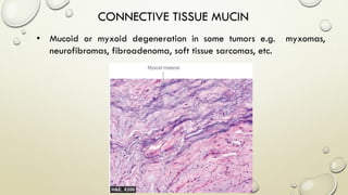 CONNECTIVE TISSUE MUCIN
• Mucoid or myxoid degeneration in some tumors e.g. myxomas,
neurofibromas, fibroadenoma, soft tissue sarcomas, etc.
 