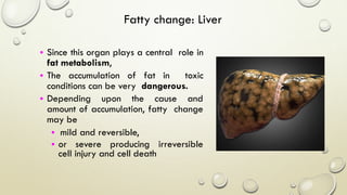 Fatty change: Liver
• Since this organ plays a central role in
fat metabolism,
• The accumulation of fat in toxic
conditions can be very dangerous.
• Depending upon the cause and
amount of accumulation, fatty change
may be
• mild and reversible,
• or severe producing irreversible
cell injury and cell death
 