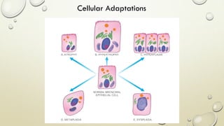 Cellular Adaptations
 