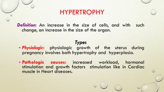 HYPERTROPHY
Definition: An increase in the size of cells, and with such
change, an increase in the size of the organ.
Types
• Physiologic: physiologic growth of the uterus during
pregnancy involves both hypertrophy and hyperplasia.
• Pathologic causes: increased workload, hormonal
stimulation and growth factors stimulation like in Cardiac
muscle in Heart diseases.
 