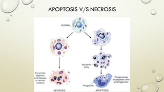 APOPTOSIS V/S NECROSIS
 