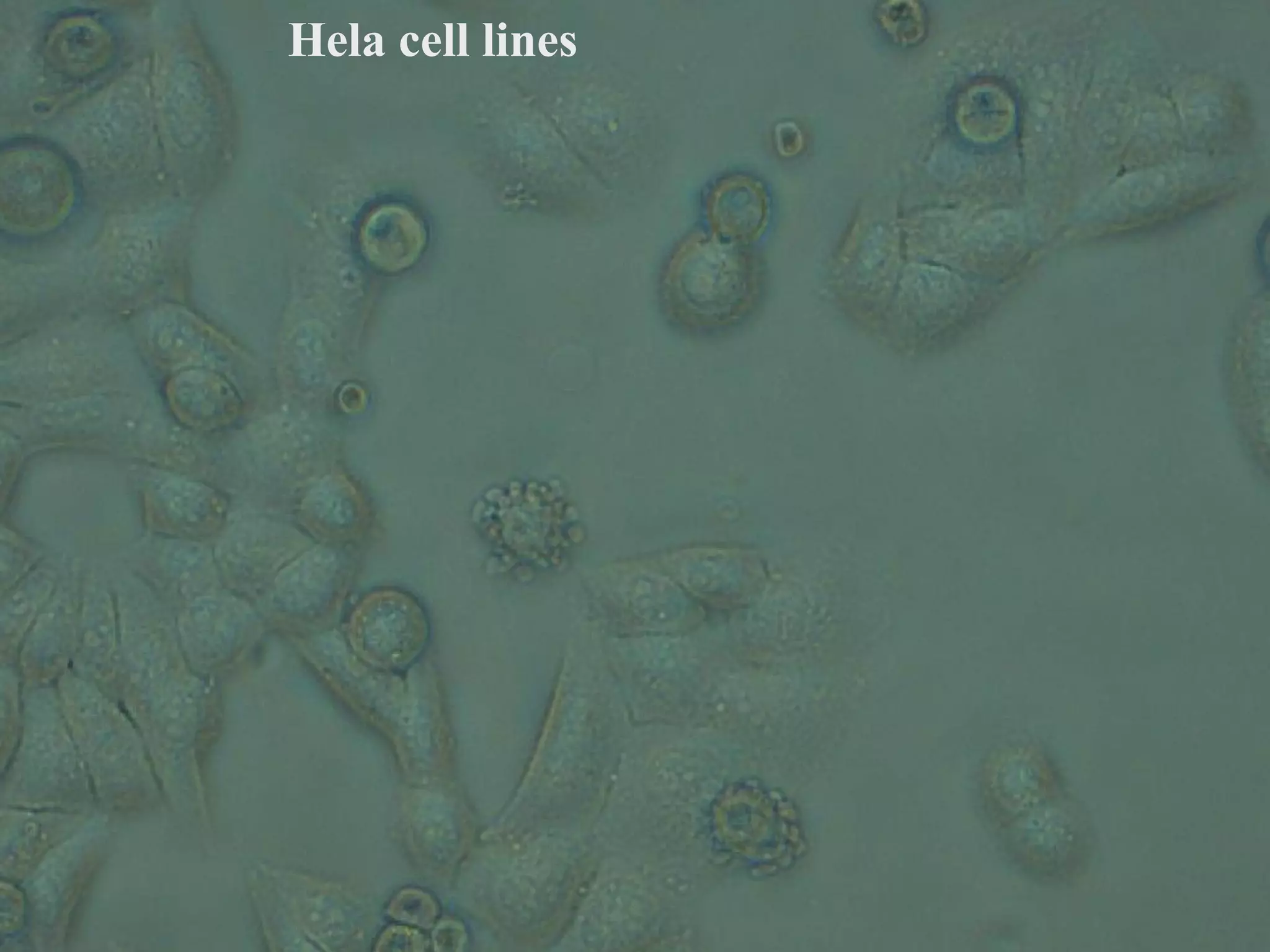 Hela cell lines
 