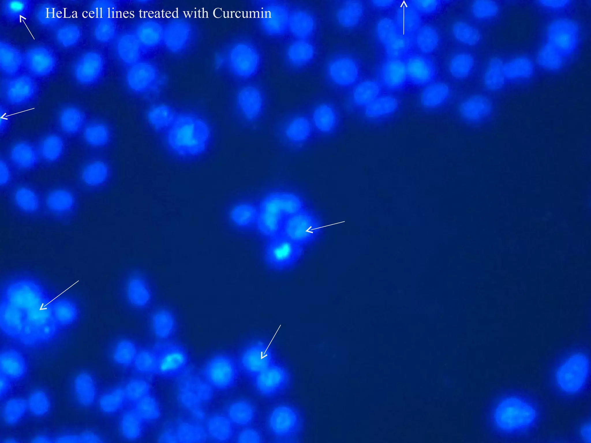 HeLa cell lines treated with Curcumin
 