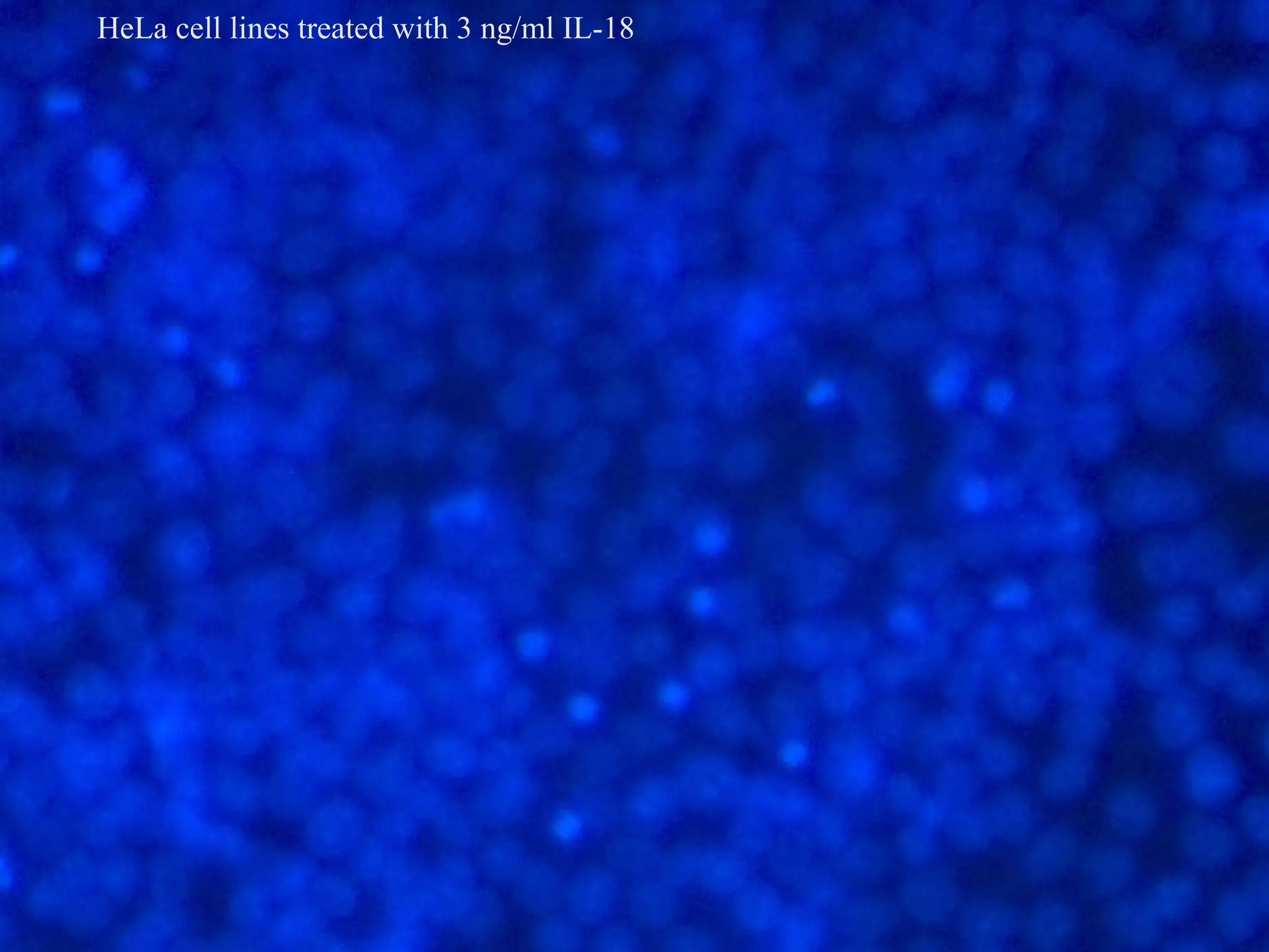 HeLa cell lines treated with 3 ng/ml IL-18
 