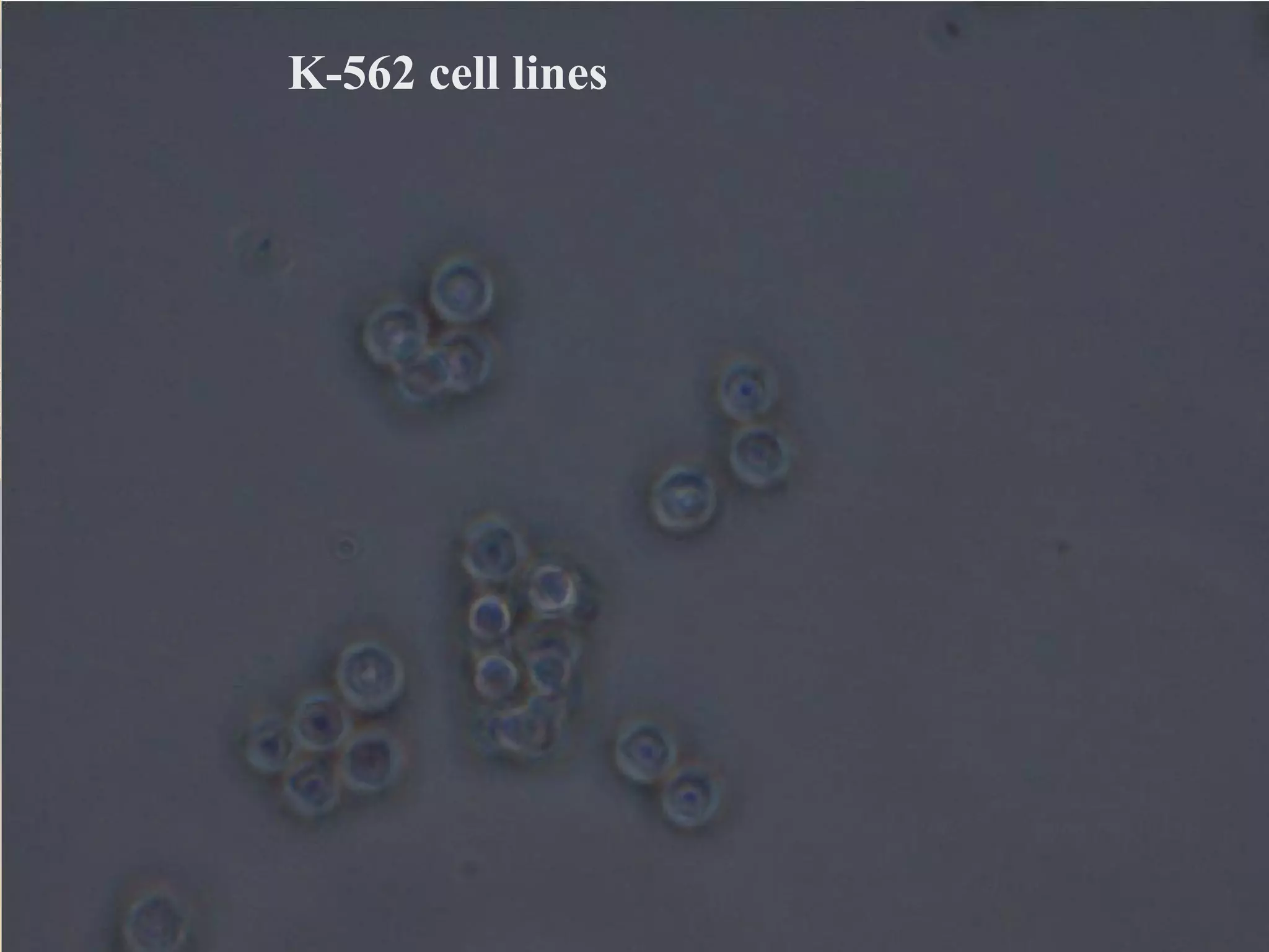 K-562 cell lines
 