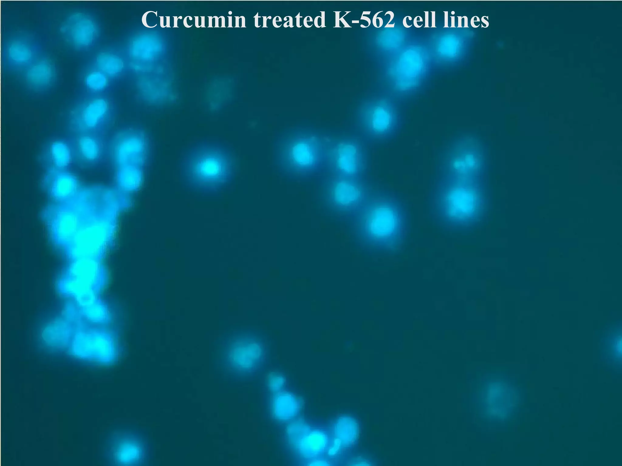 Curcumin treated K-562 cell lines
 