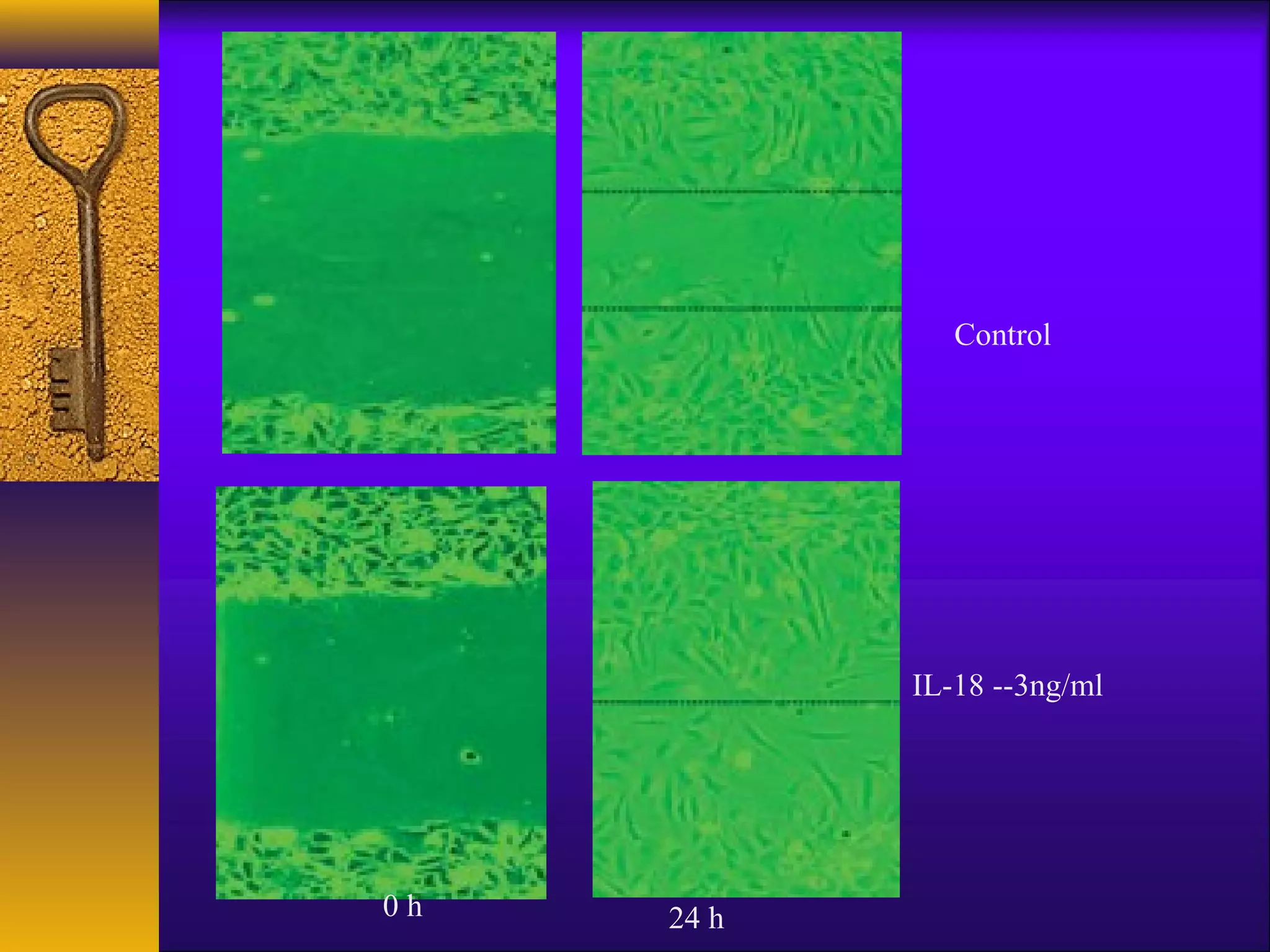 Control




            IL-18 --3ng/ml




0h   24 h
 
