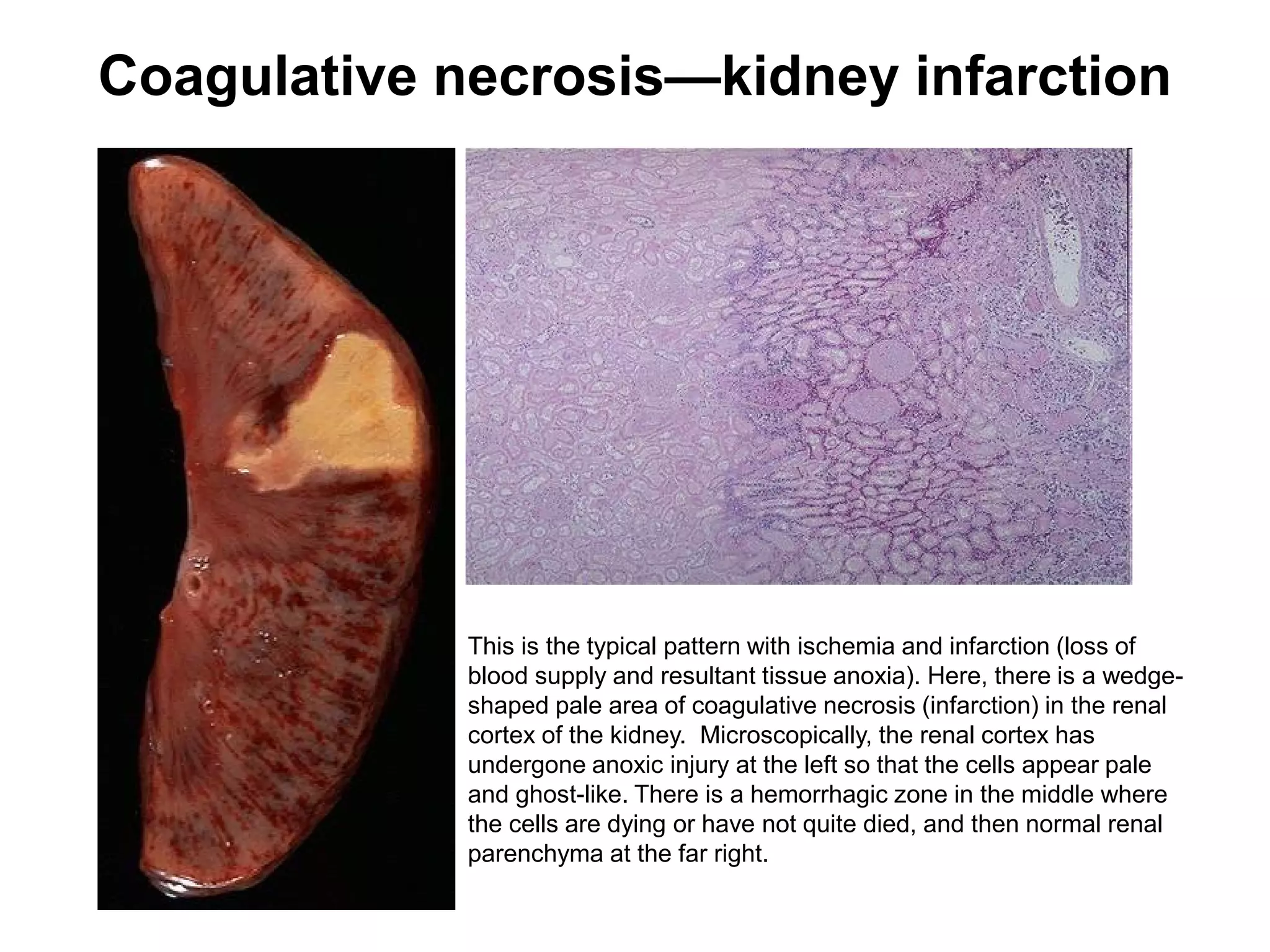 Cell Necrosis Apoptosis Presentation pdf