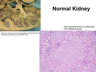 http://www.med.umich.edu/lrc/coursepages/m1/anatomy2010/htm
l/quizzes/practical/kidney_practical/s20.14.htm
Normal Kidney
http://www.bmb.leeds.ac.uk/illingwort
h/bioc3800/kidney.jpg
 
