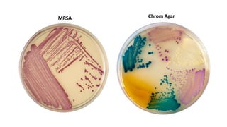 MRSA Chrom Agar
 