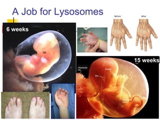A Job for Lysosomes
15 weeks
6 weeks
 