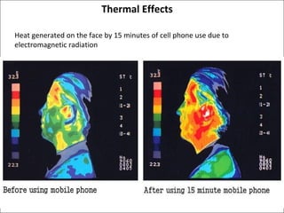 Thermal Effects
Heat generated on the face by 15 minutes of cell phone use due to
electromagnetic radiation

 