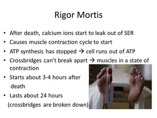 Rigor Mortis
 