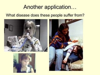 Another application… What disease does these people suffer from? 