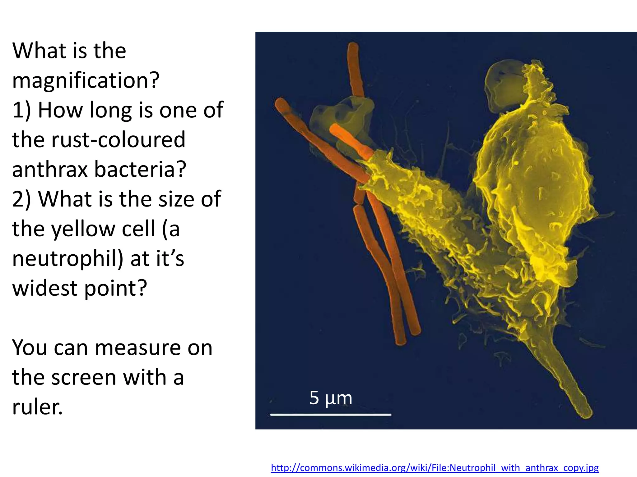 What is the
magnification?
1) How long is one of
the rust-coloured
anthrax bacteria?
2) What is the size of
the yellow cell (a
neutrophil) at it’s
widest point?

You can measure on
the screen with a
ruler.                           5 μm


                         http://commons.wikimedia.org/wiki/File:Neutrophil_with_anthrax_copy.jpg
 