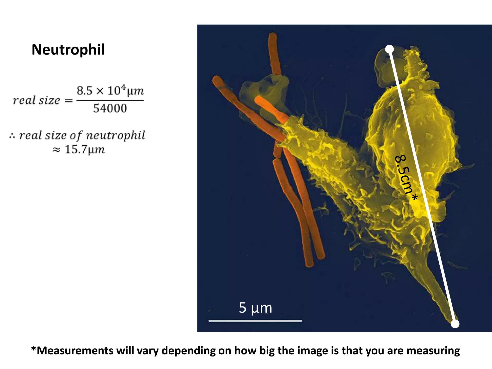 Neutrophil




                                      5 μm

*Measurements will vary depending on how big the image is that you are measuring
 