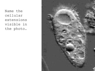 Name the
cellular
extensions
visible in
the photo.
 