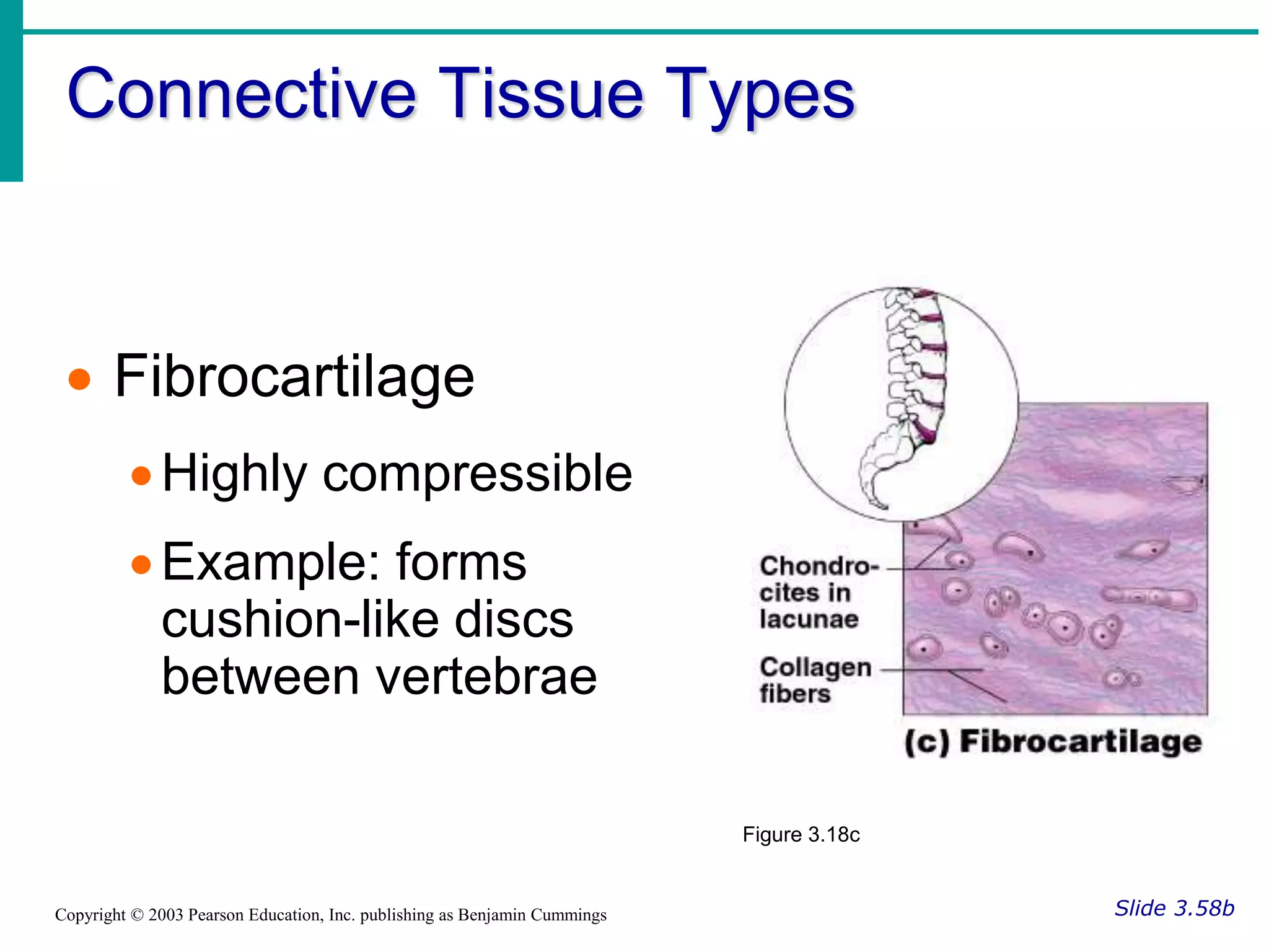 Connective Tissue Types
Slide 3.58b
Copyright © 2003 Pearson Education, Inc. publishing as Benjamin Cummings
 Fibrocartilage
Highly compressible
Example: forms
cushion-like discs
between vertebrae
Figure 3.18c
 