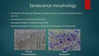 Senescence morphology
 Senescent cells become flattened, enlarged and have increased β-galactosidase
activity
 Increased size of nucleus and nucleoli
 Increased number of multinucleated cells
 Increased number of lysosomes, Golgi and cytoplasmic microfilaments
'Young'
Pre-senescent
'Aged'
Senescent
 