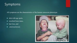 Symptoms
All symptoms are the characteristics of the human senescent phenotype.
 skin with age spots,
 resorbed bone mass,
 hair loss, and
 arteriosclerosis
 