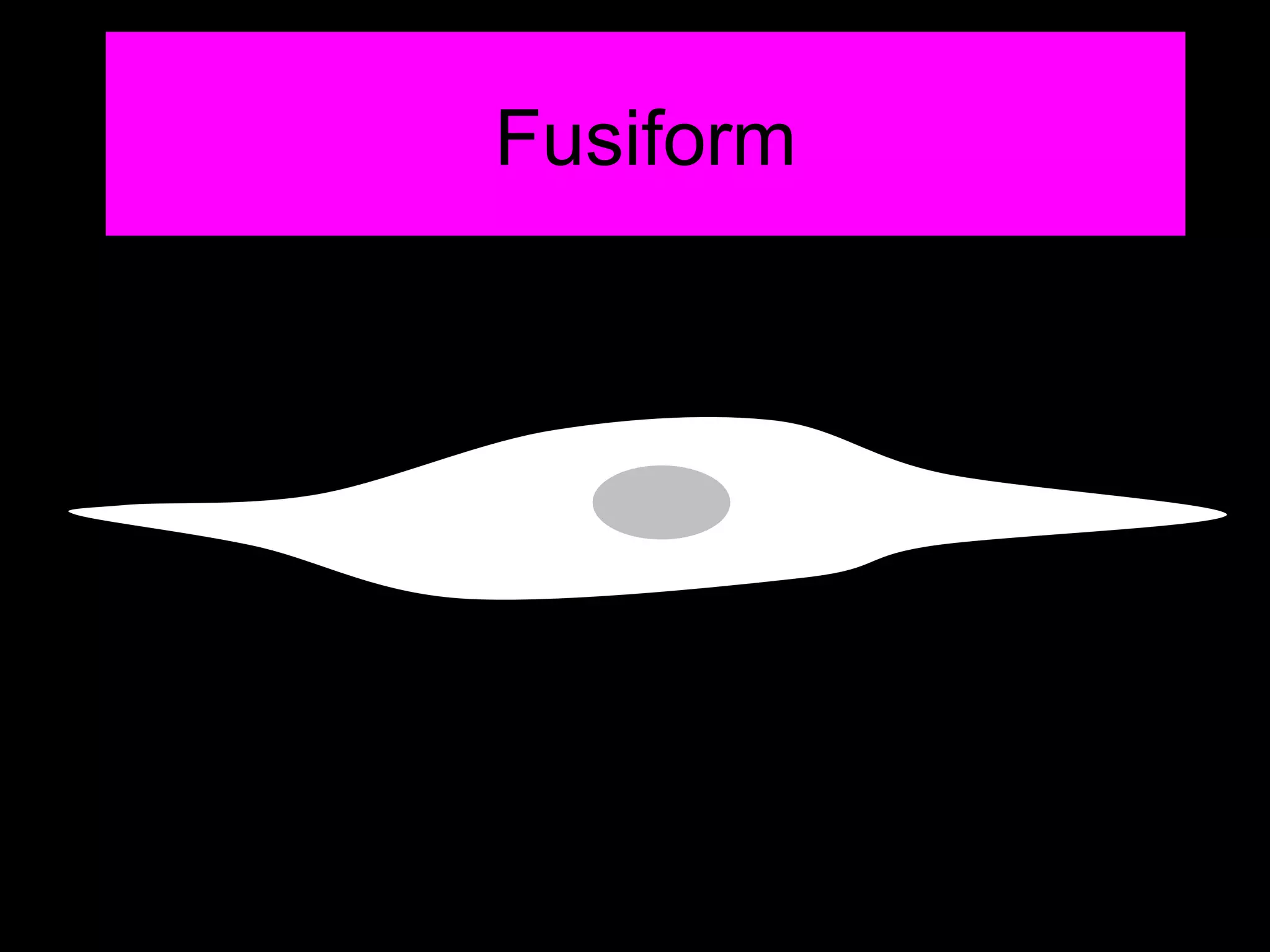 Fusiform 