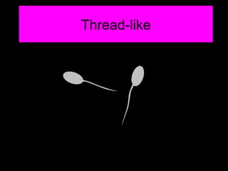 Thread-like