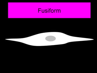 Fusiform