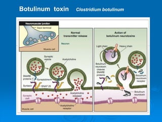 Botulinum toxin Clostridium botulinum
 