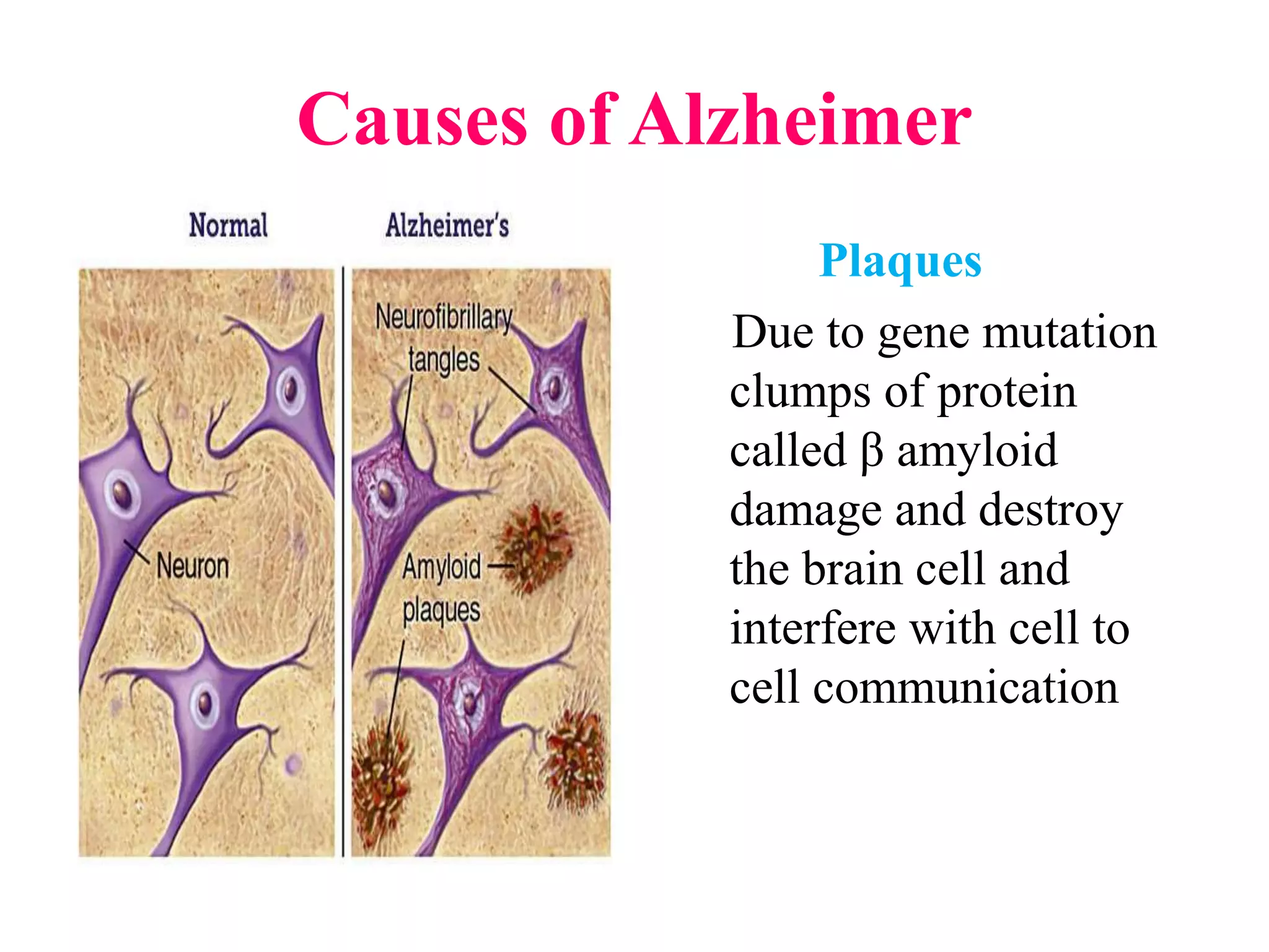 Causes of Alzheimer
Plaques
Due to gene mutation
clumps of protein
called β amyloid
damage and destroy
the brain cell and
interfere with cell to
cell communication
 