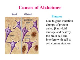 Causes of Alzheimer
Plaques
Due to gene mutation
clumps of protein
called β amyloid
damage and destroy
the brain cell and
interfere with cell to
cell communication
 