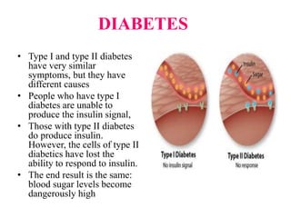 DIABETES
• Type I and type II diabetes
have very similar
symptoms, but they have
different causes
• People who have type I
diabetes are unable to
produce the insulin signal,
• Those with type II diabetes
do produce insulin.
However, the cells of type II
diabetics have lost the
ability to respond to insulin.
• The end result is the same:
blood sugar levels become
dangerously high
 