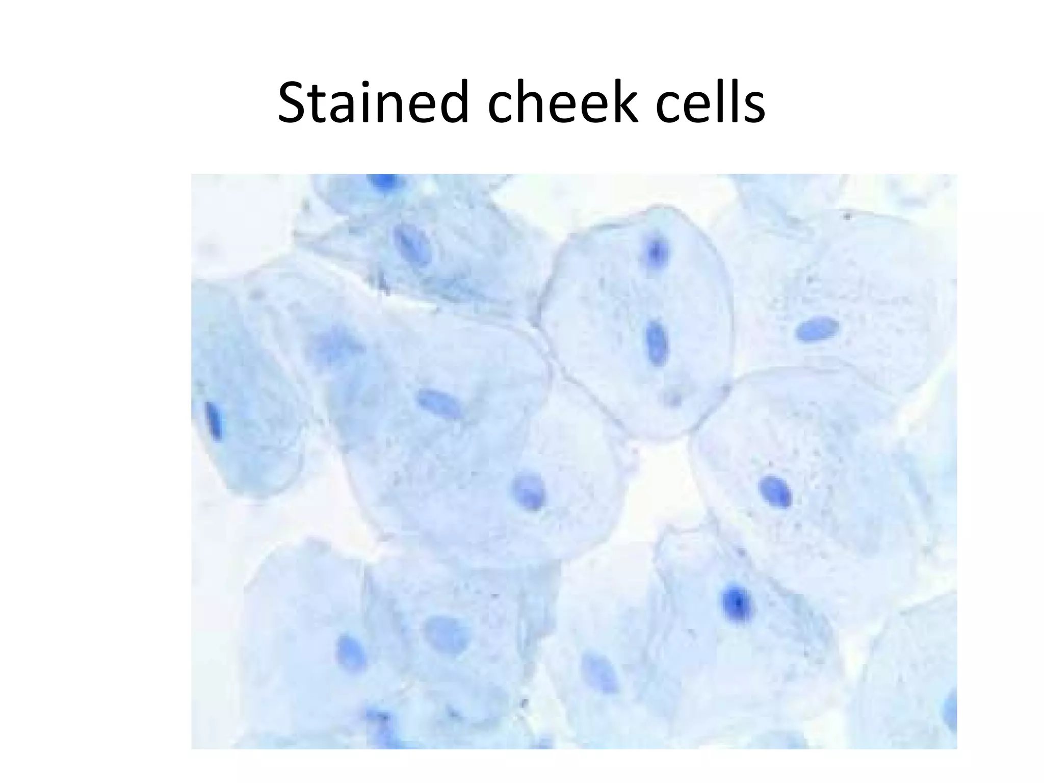 Stained cheek cells