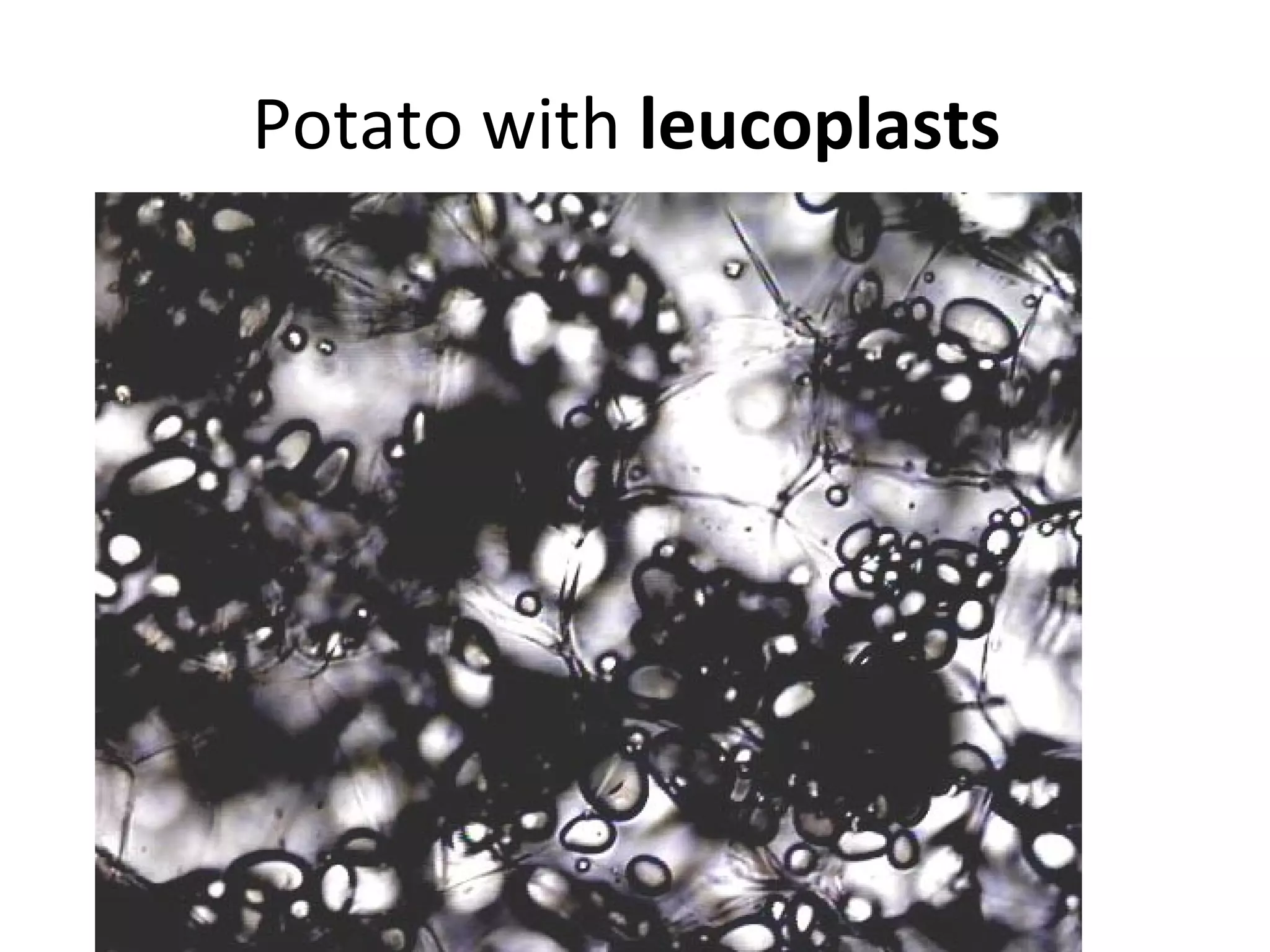 Potato with leucoplasts