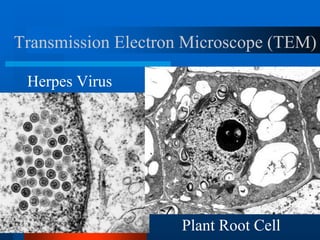 Transmission Electron Microscope (TEM)
Herpes Virus
Plant Root Cell
 