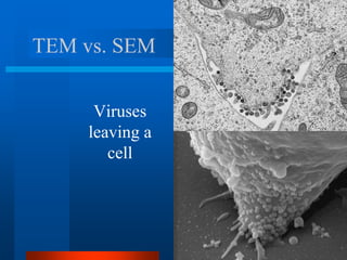 TEM vs. SEM
Viruses
leaving a
cell
 