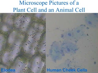 Microscope Pictures of a
Plant Cell and an Animal Cell
Elodea Human Cheek Cells
 