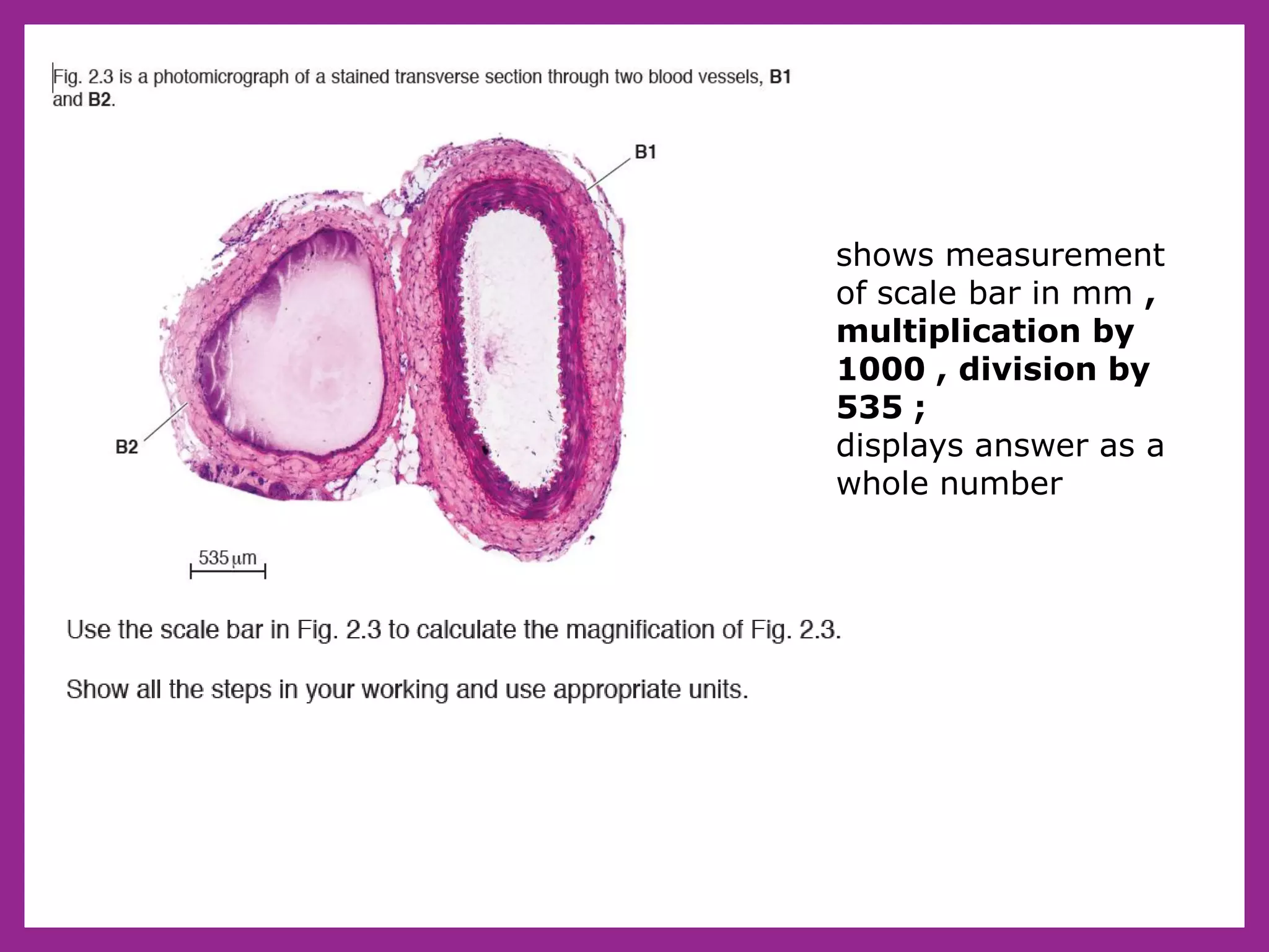 shows measurement
of scale bar in mm ,
multiplication by
1000 , division by
535 ;
displays answer as a
whole number
 