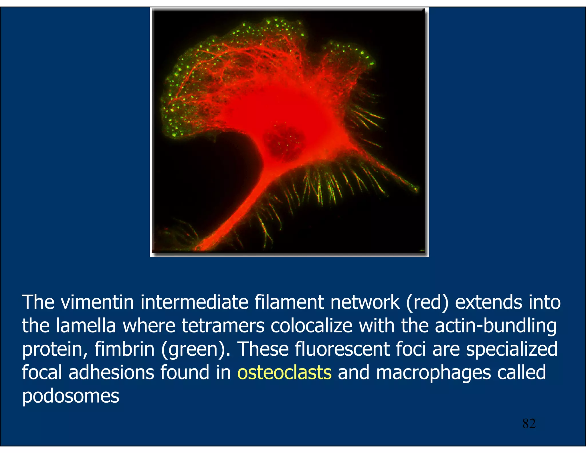 82
The vimentin intermediate filament network (red) extends into
the lamella where tetramers colocalize with the actin-bundling
protein, fimbrin (green). These fluorescent foci are specialized
focal adhesions found in osteoclasts and macrophages called
podosomes
 