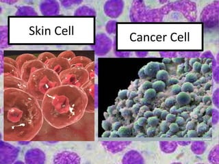 Skin Cell Cancer Cell
 