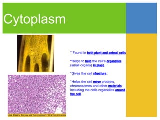 Cytoplasm

            * Found in both plant and animal cells

            *Helps to hold the cell's organelles
            (small organs) in place.

            *Gives the cell structure.

            *Helps the cell move proteins,
            chromosomes and other materials
            including the cells organelles around
            the cell.
 