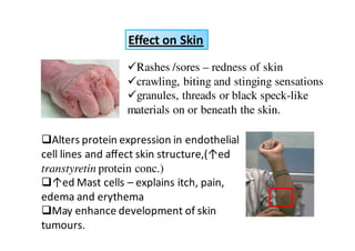 Effect on Skin
                   Rashes /sores – redness of skin
                   crawling, biting and stinging sensations
                   granules, threads or black speck-like
                  materials on or beneath the skin.

  Alters protein expression in endothelial
cell lines and aﬀect skin structure,(↑ed
transtyretin protein conc.)
  ↑ed ast cells – explains itch, pain,
edema and erythema
      ay enhance development of skin
tumours.
 