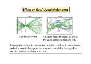 Effect on Eye/ Uveal Melanoma




        Good quality lens     Ability to focus the laser beam at
                              the various locations is altered.

Prolonged exposure to microwave radiation can lead to macroscopic
and microscopic damage to the lens and part of this damage does
not heal and accumulates with time.
 