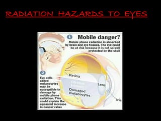 RADIATION HAZARDS TO EYES
 