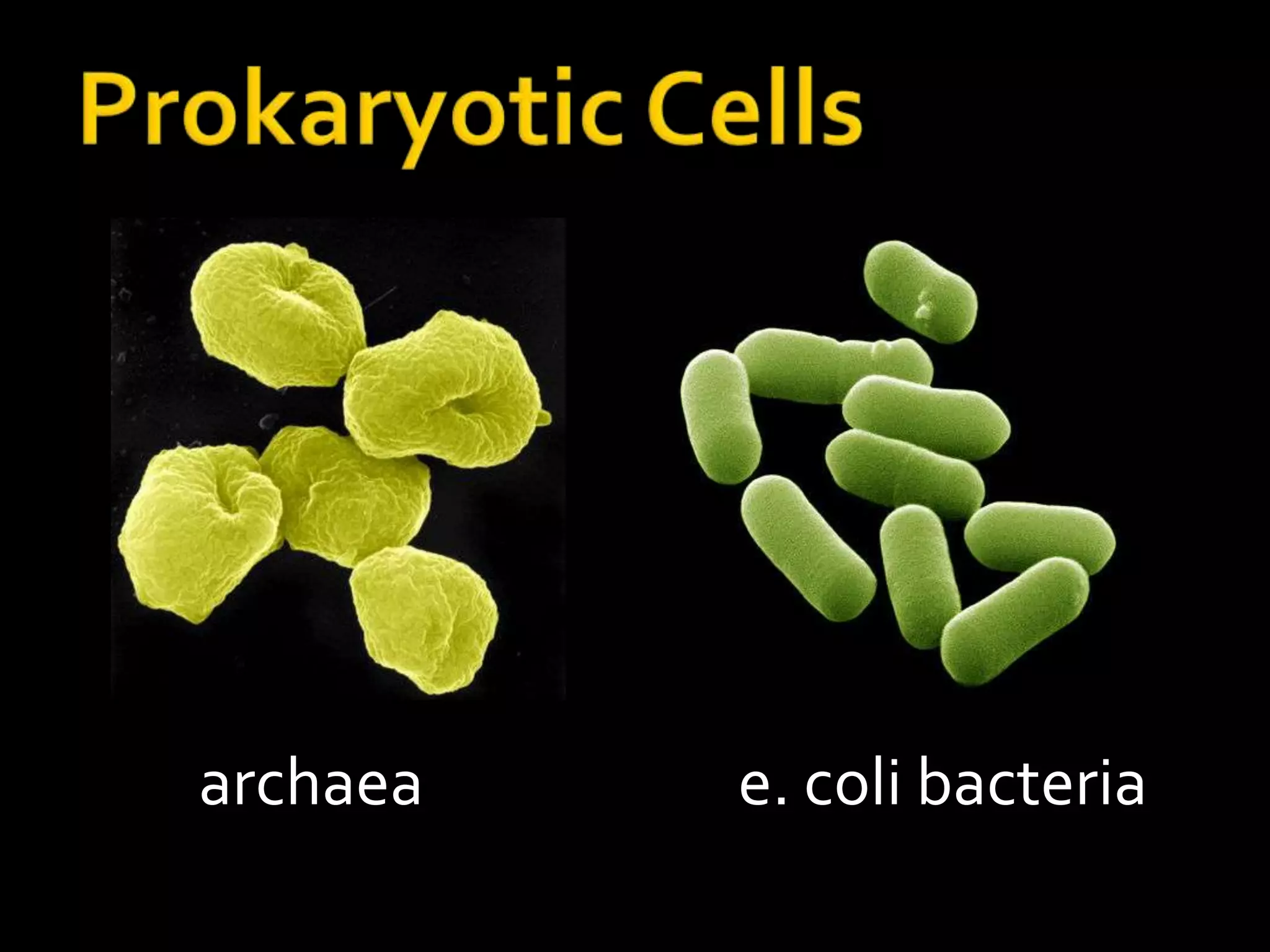 Prokaryotic Cellsarchaeae. coli bacteria