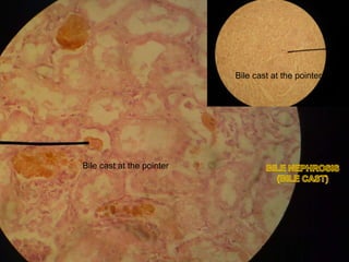 Patho-Lab 22nd Sept Cellular Accumulations | PPTX