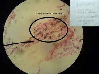 Patho-Lab 22nd Sept Cellular Accumulations | PPTX