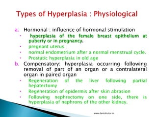 a. Hormonal : influence of hormonal stimulation
 hyperplasia of the female breast epithelium at
puberty or in pregnancy.
 pregnant uterus
 normal endometrium after a normal menstrual cycle.
 Prostatic hyperplasia in old age
b. Compensatory: hyperplasia occurring following
removal of part of an organ or a contralateral
organ in paired organ
 Regeneration of the liver following partial
hepatectomy
 Regeneration of epidermis after skin abrasion
 Following nephrectomy on one side, there is
hyperplasia of nephrons of the other kidney.
www.dentaltutor.in
 